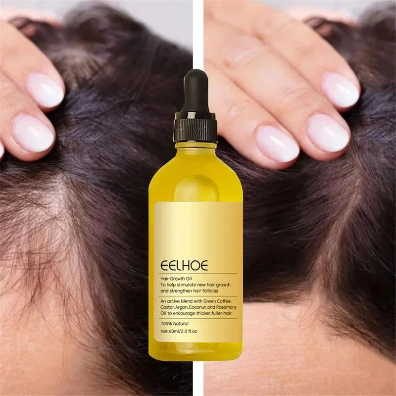 EELHOE Oil Prevent Hair Loss & Scalp Treatment - AKStore